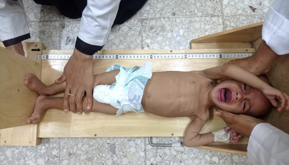 Verden passerer nå 8 milliarder mennesker, men mange nyfødte i fattige og krigsherjede land, som denne lille gutten i Jemen, går en utrygg framtid i møte.